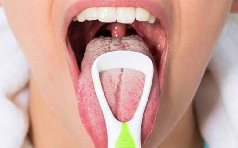 Không chỉ chải răng, bạn cần chú ý chải cả lưỡi đúng cách để loại bỏ mảng bám