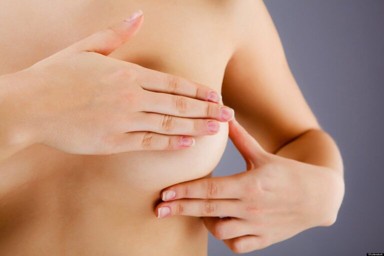 Kiểm tra ngực thường xuyên để phát hiện hạch bất thường