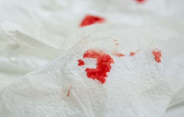 Đặt thuốc viêm cổ tử cung bị chảy máu là một trong những hiện tượng khá nguy hiểm chị em cần cẩn trọng