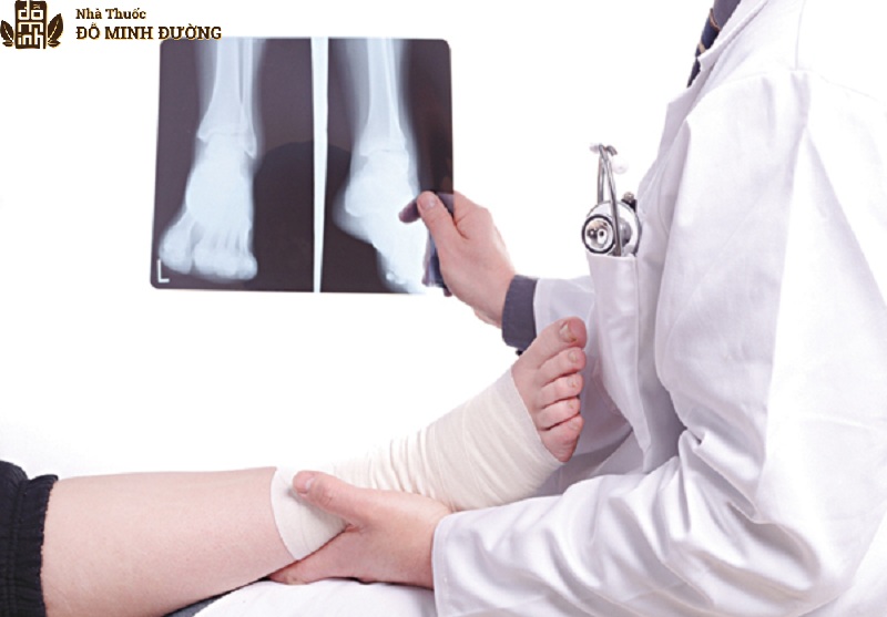 Chấn thương là nguyên nhân dẫn tới cổ chân bị viêm đau