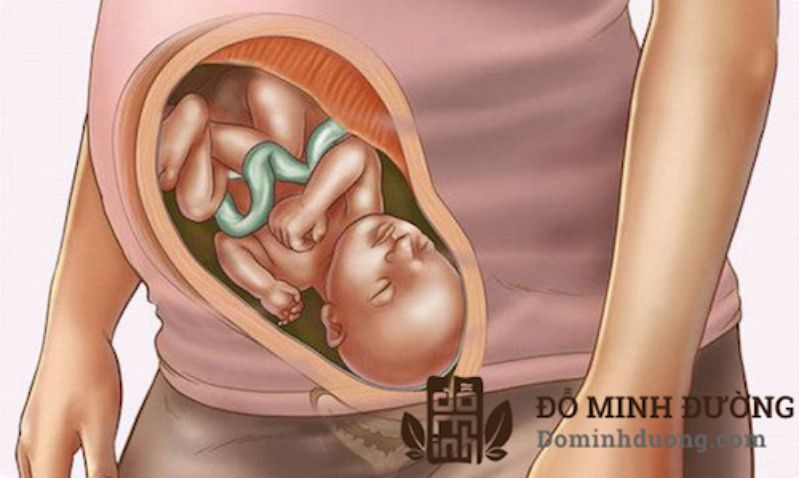 Thai 36 tuần bị đau khớp háng do vị trí thai