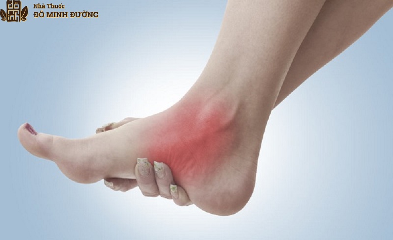 Viêm khớp cổ chân thường gây ra những cơn đau nhức khó chịu