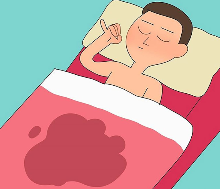 Chứng mộng tinh khiến nam giới đạt cực khoái và giải phóng tinh dịch trong khi ngủ