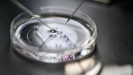 Tinh trùng dị dạng có làm IVF được không?