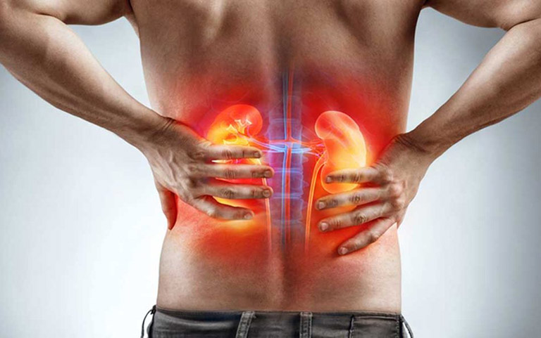 Chứng thận âm hư thường gây đau mỏi lưng