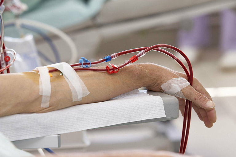 Lọc máu cấp cứu cho những bệnh nhân không đáp ứng với điều trị nội khoa