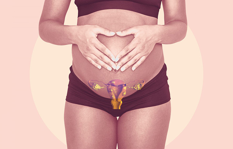 Khối u xơ phát triển nhanh có thể khiến thai chậm phát triển