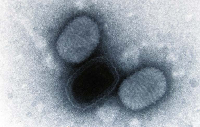 Nhiễm virus Molluscum Contagiosum (MCV) 