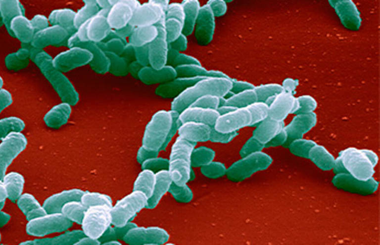 Nhiễm trùng do vi khuẩn