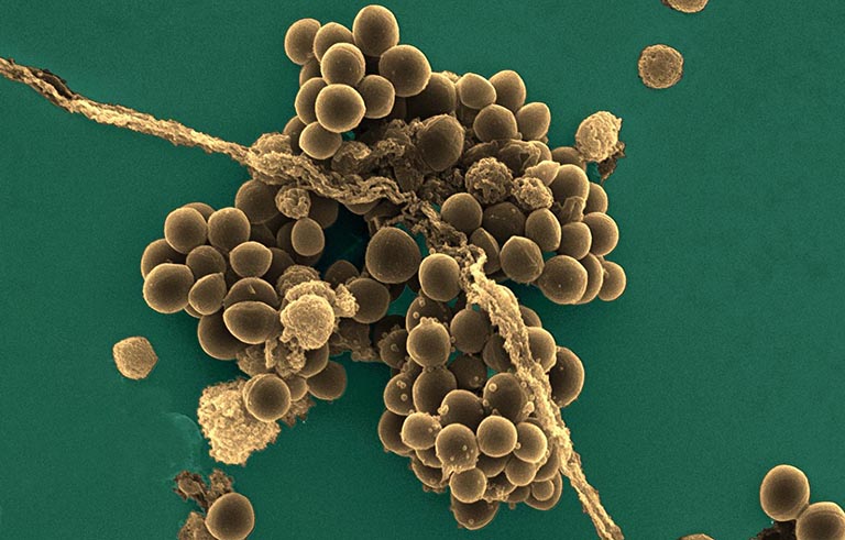 Staphylococcus aureus (tụ cầu khuẩn)
