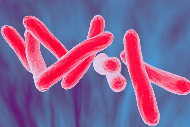 Vi khuẩn lao (Mycobacterium tuberculosis) là nguyên nhân gây viêm tinh hoàn