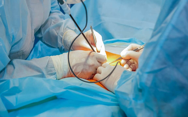Phẫu thuật nội soi loại bỏ u nang