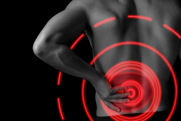 Căng cơ lưng khiến người bệnh đột ngột co thắt cơ không kiểm soát được