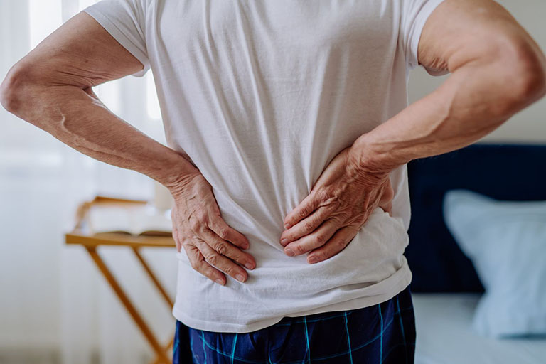 U nang hoạt dịch gây hẹp ống sống dẫn đến đau lưng