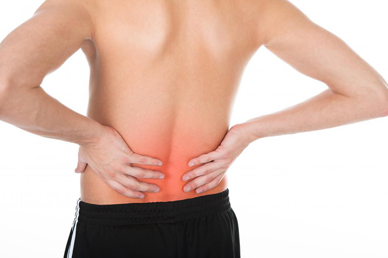Khối u cột sống gây đau lưng